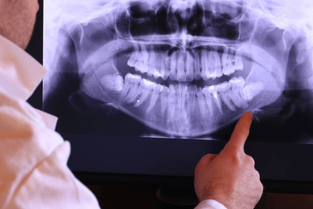 Best Emergency Treatment for Dental Infections or Abscesses in Wickes, AR