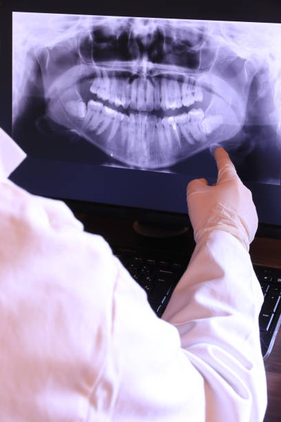 Best Emergency Tooth Extraction in Wickes, AR